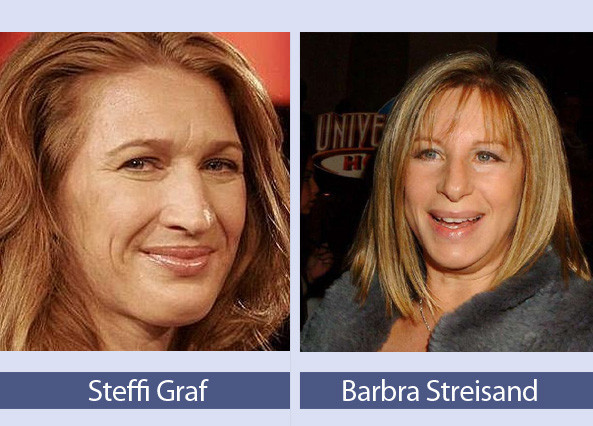 Cựu tay vợt số 1 thế giới Steffi Graf giống như em gái của Barbra Streisand.