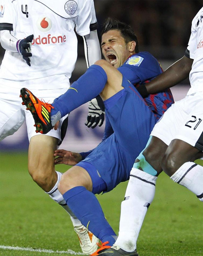 Villa tỏ ra rất đau đớn. Villa tỏ ra rất đau đớn.