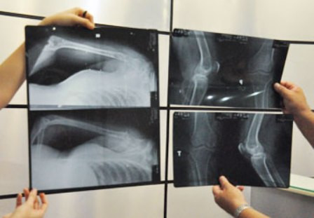 Thủ đoạn tráo phim của Khoa Chấn đoán hình ảnh gây thiệt hại hàng tỷ đồng mỗi năm cho bệnh nhân Thủ đoạn tráo phim của Khoa Chấn đoán hình ảnh gây thiệt hại hàng tỷ đồng mỗi năm cho bệnh nhân