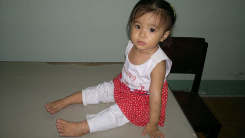 Cháu Ngọc bị cô giữ trẻ đánh. Cháu Ngọc bị cô giữ trẻ đánh.