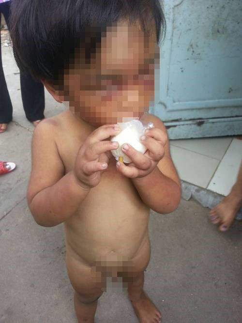 Vì bị bỏ đói thường xuyên nên cháu Đức ăn ngấu nghiến những gì mình xin được Vì bị bỏ đói thường xuyên nên cháu Đức ăn ngấu nghiến những gì mình xin được