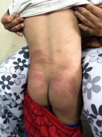 Thân thể mỏng manh của một đứa bé 3 tuổi đã phải sớm nhận lấy những điều kinh tởm nhất