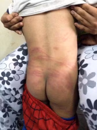 Thân thể mỏng manh của một đứa bé 3 tuổi đã phải sớm nhận lấy những điều kinh tởm nhất