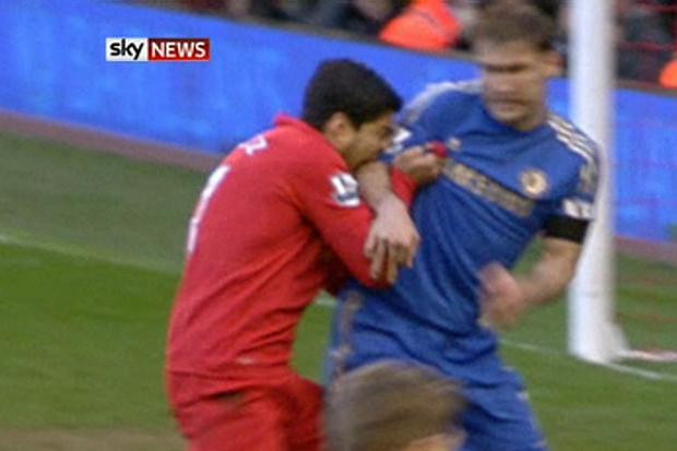 Suarez cắn đối thủ. Suarez cắn đối thủ.