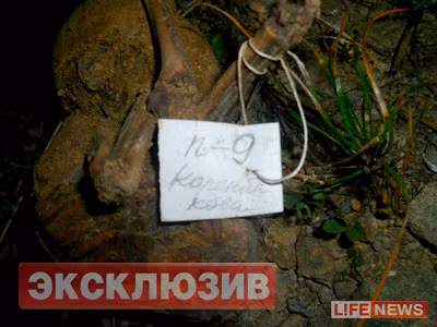 Một bào thai có nhãn ghi tên mẹ và con số ám chỉ tuần thai hoặc tên bệnh viện.