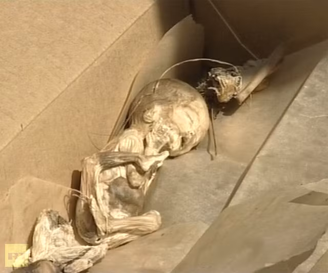 Các bào thai khô được xác định đã có ít nhất 10 năm.