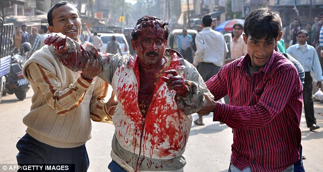 Thân thể đẫm máu của người đàn ông sau khi được giải thoát khỏi nanh vuốt của con vật đi lạc Thân thể đẫm máu của người đàn ông sau khi được giải thoát khỏi nanh vuốt của con vật đi lạc