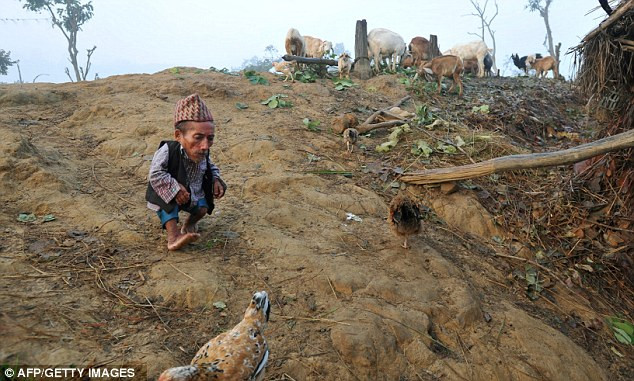 Nguyên nhân dẫn tới sự hạn chế chiều cao của ông Dangi vẫn chưa được chẩn đoán, nhưng theo một số phân tích, có thể ông mắc phải chứng bệnh lùn bẩm sinh (primordial dwarfism).