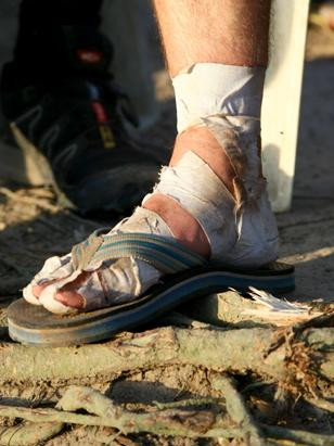 Đến ngày thứ 4, các vận động viên bắt đầu kiệt sức và phàn nàn. Nhiều người da chân bong tróc như người bị khô da.