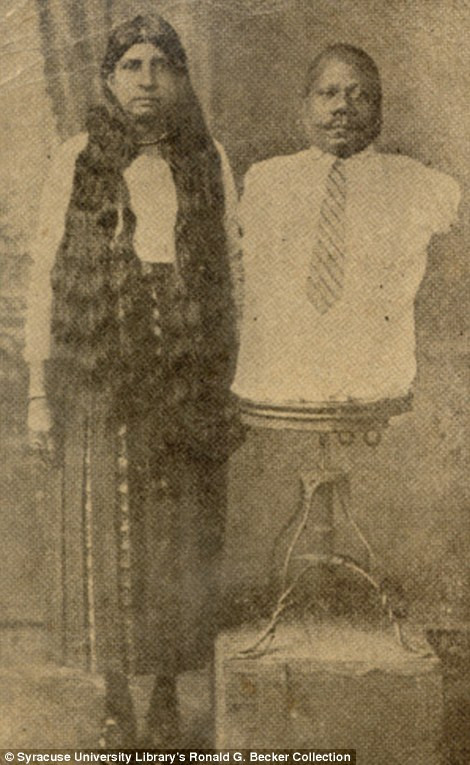 Prince Randian (phải) khi sinh ra đã không có chân tay nhưng có thể cạo râu, vẽ, viết và thậm chí là cuộn được thuốc lá. Prince Randian (phải) khi sinh ra đã không có chân tay nhưng có thể cạo râu, vẽ, viết và thậm chí là cuộn được thuốc lá.