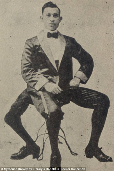 Frank Lentini, sinh ra tại Sicily, có 3 chân. Frank Lentini, sinh ra tại Sicily, có 3 chân.