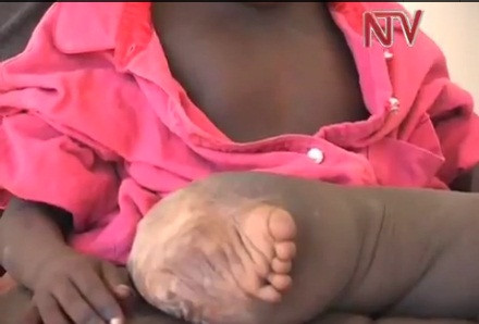 Một tổ chức từ thiện đã đứng ra kêu gọi các chuyên gia của Anh đến giúp cậu bé.