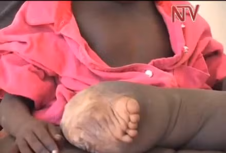 Một tổ chức từ thiện đã đứng ra kêu gọi các chuyên gia của Anh đến giúp cậu bé.