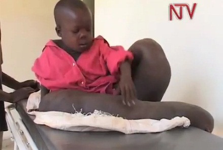 Trong tuần tới một bác sĩ từ Anh sẽ đến khám và tìm hiểu căn bệnh của Vincent.