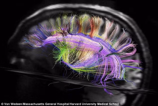 Hình ảnh cấu trúc não người