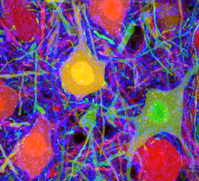 Tế bào thần kinh trong não người