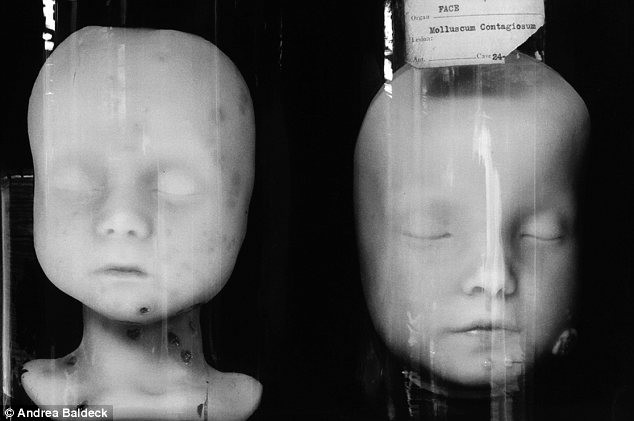 Mặt nạ sáp mô phỏng trẻ em bị mọc mụn trên mặt và cổ