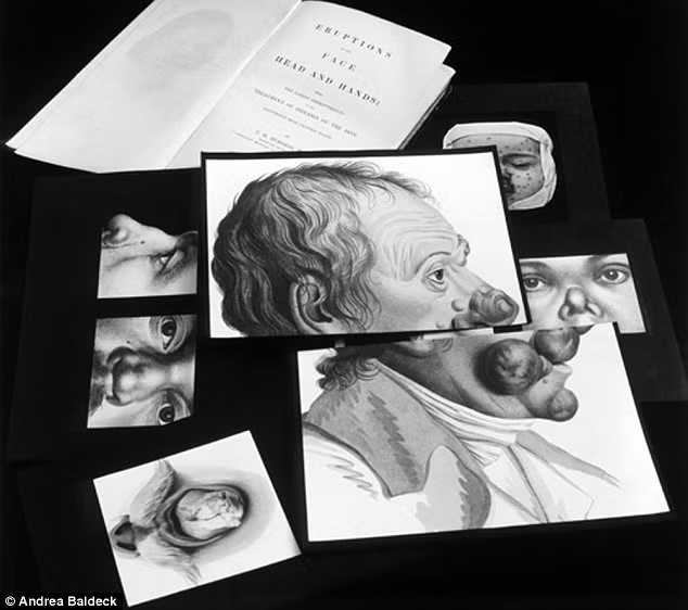 Ảnh dùng để chẩn đoán và điều trị bệnh ảnh hưởng tới mặt