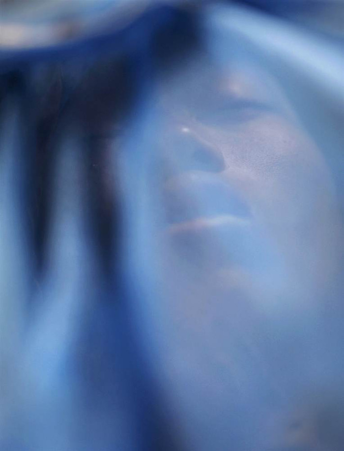 Eiphyu Khine, một phụ nữ nhiễm HIV dương tính và có chồng chết vì bệnh AIDS, ẩn dưới tấm màn chống muỗi tại nhà tế bần dành cho những người nhiễm HIV/AIDS tại Yagon, Myanmar ngày 26/5.