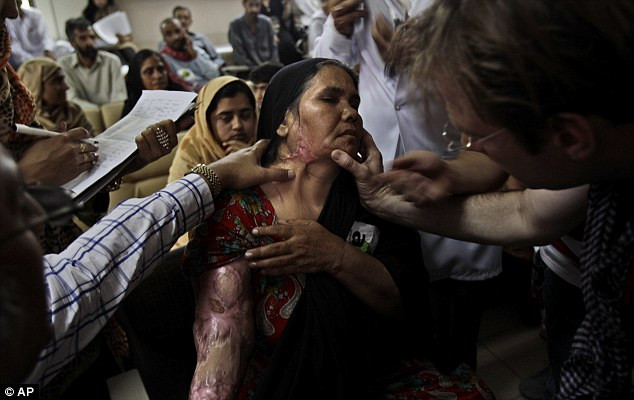 Parveen Aslam, 42 tuổi, và con gái Zaiba bị tạt a-xít hồi tháng 12/2011 bởi một người đàn ông khi bà từ chối gả cô bé cho một người đàn ông lớn tuổi Parveen Aslam, 42 tuổi, và con gái Zaiba bị tạt a-xít hồi tháng 12/2011 bởi một người đàn ông khi bà từ chối gả cô bé cho một người đàn ông lớn tuổi