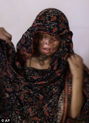 Zaiba Aslam, 10 tuổi, may mắn sống sót sau một vụ tấn công bằng a-xít. Zaiba Aslam, 10 tuổi, may mắn sống sót sau một vụ tấn công bằng a-xít.