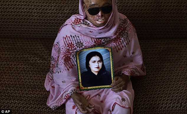 Naziran Bibi, 25 tuổi, bị tạt a-xít bởi một người giấu tên lúc đang ngủ trong năm 2008. Naziran Bibi, 25 tuổi, bị tạt a-xít bởi một người giấu tên lúc đang ngủ trong năm 2008.