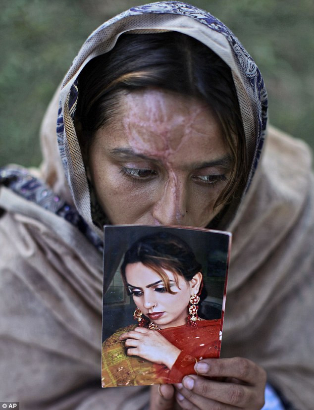 Shamma Maqsood, 24 tuổi, cầm tấm ảnh chân dung trước khi cô bị chồng tấn công bằng a-xít vào ngày 20/3/2012 sau cuộc tranh luận về việc anh ta thất nghiệp. Shamma Maqsood, 24 tuổi, cầm tấm ảnh chân dung trước khi cô bị chồng tấn công bằng a-xít vào ngày 20/3/2012 sau cuộc tranh luận về việc anh ta thất nghiệp.