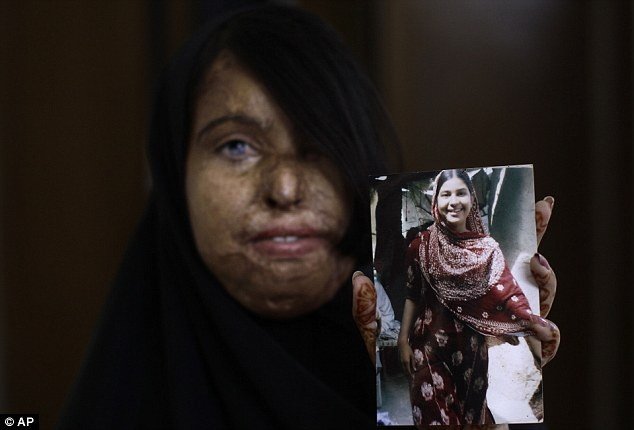 Naila Farhat, 22 tuổi, bị tấn công bằng a-xít bởi một người bạn của cô giáo sau khi gia đình cô từ chối nhận lời cầu hôn của anh ta. Rất nhiều phụ nữ khác ở nước này đã bị chồng đánh đập thậm tệ, cắt xẻo da thịt và tạt a-xít vì cái mà họ gọi là "danh dự gia đình". Naila Farhat, 22 tuổi, bị tấn công bằng a-xít bởi một người bạn của cô giáo sau khi gia đình cô từ chối nhận lời cầu hôn của anh ta. Rất nhiều phụ nữ khác ở nước này đã bị chồng đánh đập thậm tệ, cắt xẻo da thịt và tạt a-xít vì cái mà họ gọi là "danh dự gia đình".
