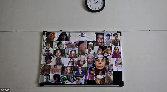 Tấm bảng treo ảnh của những người sống sót sau các vụ tấn công bằng axit được treo trong phòng của Tổ chức Những người sống sót a-xít tại Islamabad, Pakistan. Chỉ vì những lý do như bị nghi ngờ ngoại tình, muốn ly hôn, mặc trang phục không phù hợp... hàng trăm phụ nữ Pakistan đã bị chính chồng mình sát hại mỗi năm. Tấm bảng treo ảnh của những người sống sót sau các vụ tấn công bằng axit được treo trong phòng của Tổ chức Những người sống sót a-xít tại Islamabad, Pakistan. Chỉ vì những lý do như bị nghi ngờ ngoại tình, muốn ly hôn, mặc trang phục không phù hợp... hàng trăm phụ nữ Pakistan đã bị chính chồng mình sát hại mỗi năm.