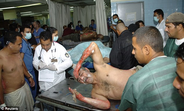 Nạn nhân vụ hỏa hoạn bị thương được điều trị tại bệnh viện