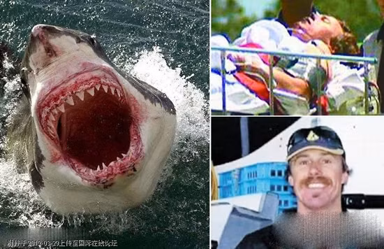 Một thợ lặn trẻ sống sót sau cuộc đụng độ với cá mập. Một thợ lặn trẻ sống sót sau cuộc đụng độ với cá mập.