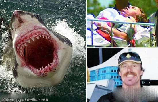 Một thợ lặn trẻ sống sót sau cuộc đụng độ với cá mập. Một thợ lặn trẻ sống sót sau cuộc đụng độ với cá mập.