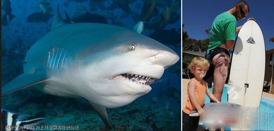 Vận động viên lướt sóng Glen Folkard (Úc) khoe vết thương khủng khiếp sau khi bị cá mập tấn công. Vận động viên lướt sóng Glen Folkard (Úc) khoe vết thương khủng khiếp sau khi bị cá mập tấn công.