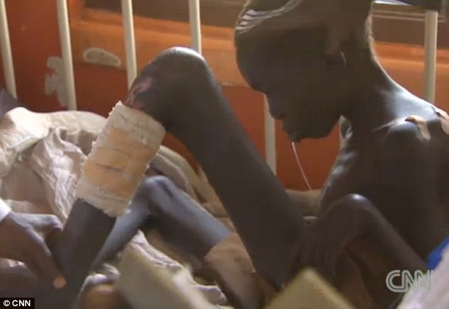 Nhiều trẻ em bị bệnh gật đầu chết vì suy dinh dưỡng vì bệnh khiến chúng lơ là cả việc ăn uống. Nhiều trẻ em bị bệnh gật đầu chết vì suy dinh dưỡng vì bệnh khiến chúng lơ là cả việc ăn uống.