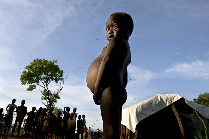 Bolis Jamal, 3 tuổi, bị suy dinh dưỡng đứng gần nơi tạm trú của gia đình tại trại tị nạn Yida nằm dọc biên giới phía bắc của Sudan ngày 1/7. Cả nhà cậu bé đến đây vài tháng trước để chạy trốn bạo lực tại miền bắc Sudan.