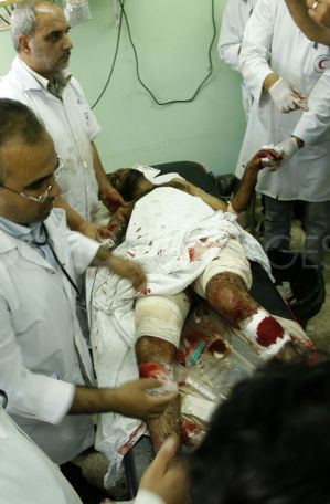 Theo các nhân viên y tế địa phương, cuộc tấn công đã cướp đi sinh mạng của ít nhất 4 người và khiến 20 người khác bị thương, gồm cả thường dân. Theo các nhân viên y tế địa phương, cuộc tấn công đã cướp đi sinh mạng của ít nhất 4 người và khiến 20 người khác bị thương, gồm cả thường dân.