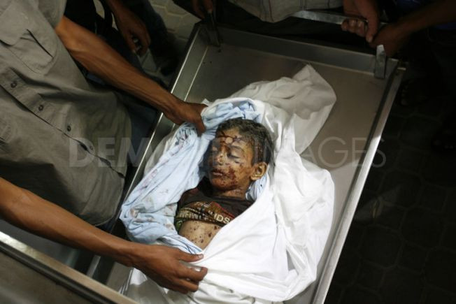 Một em bé khác cũng bị thương trong một cuộc tấn công riêng biệt của quân đội Israel tại Rafah, gần biên giới Ai Cập. Một em bé khác cũng bị thương trong một cuộc tấn công riêng biệt của quân đội Israel tại Rafah, gần biên giới Ai Cập.