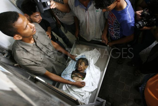 Cha của cậu bé Ali Al-Shawaf cũng bị thương trong cuộc tấn công đã cướp đi sinh mạng của con trai ông. Cha của cậu bé Ali Al-Shawaf cũng bị thương trong cuộc tấn công đã cướp đi sinh mạng của con trai ông.