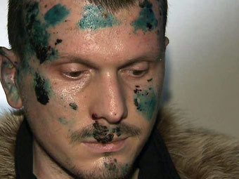 Adam Osmaev Adam Osmaev