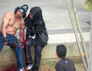 Nghi phạm nam đã bị bắn vào tay và chân đã qua đời tại bệnh viện địa phương 15 phút sau khi được cấp cứu. Người phụ nữ bị bắn vào đùi trái và đang bị giam giữ để điều tra làm rõ vụ việc. Nghi phạm nam đã bị bắn vào tay và chân đã qua đời tại bệnh viện địa phương 15 phút sau khi được cấp cứu. Người phụ nữ bị bắn vào đùi trái và đang bị giam giữ để điều tra làm rõ vụ việc.