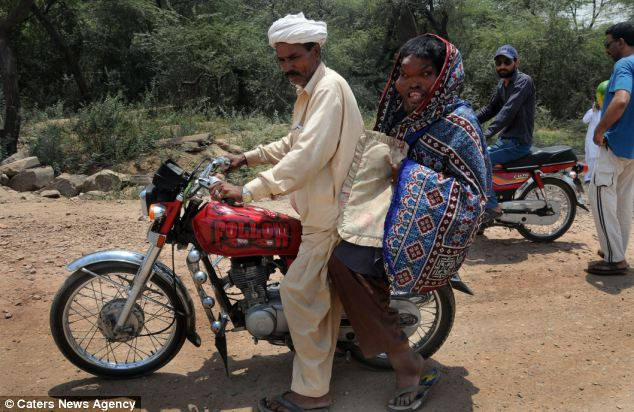 Nếu thực sự mắc phải hội chứng Proteus, các chuyên gia sẽ không có cách nào giúp giảm kích thước đầu và chân tay cho Sain. Nhưng hiện tại gia đình Sain đang hy vọng rằng có thể con trai họ bị ảnh hưởng bởi các rối loạn gây phát triển quá mức khác và có thể có phương pháp điều trị hiệu quả nào đó chấm dứt tình trạng này.