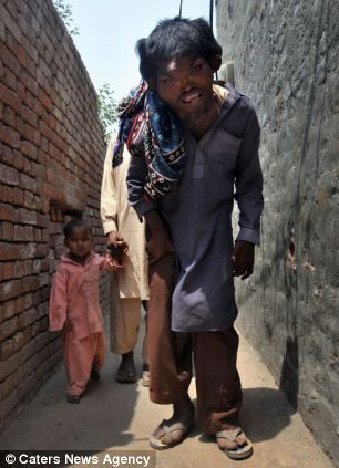 Chàng trai 22 tuổi này tin rằng anh đã bị trúng một lời nguyền hay thần thánh đã trừng phạt anh, khiến anh phải sống với một ngoại hình xấu xí và bị xa lánh.