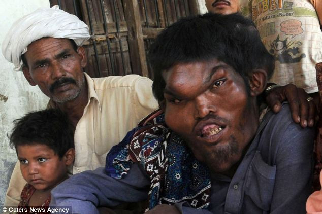 Tuy nhiên, nhờ sự động viện giúp đỡ của gia đình và bạn bè, Sain đang quyết tâm giành lại cuộc sống của mình và hy vọng của thể tìm được người bạn đời thực sự.