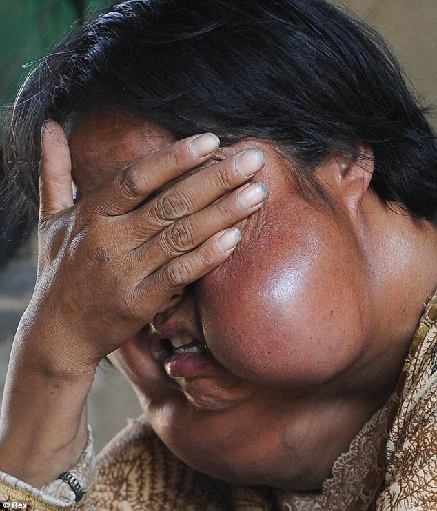 Người chồng đầu tiên của Li đã chết không lâu sau khi cô được chẩn đoán mắc bệnh ung thư xương.