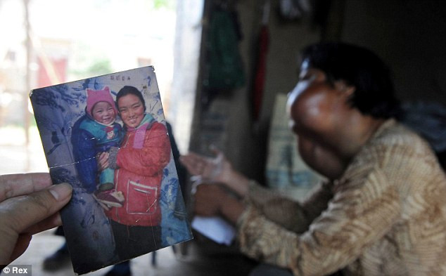 Li và một trong 2 người con trai trước khi các khối u phát triển trên mặt.