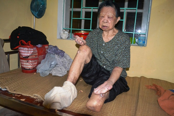 Cụ Bớt tâm sự với phóng viên