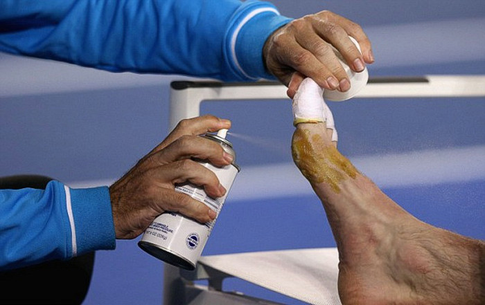 Bác sĩ đã phải xịt thuốc để giúp Murray thi đấu tiếp. Bác sĩ đã phải xịt thuốc để giúp Murray thi đấu tiếp.