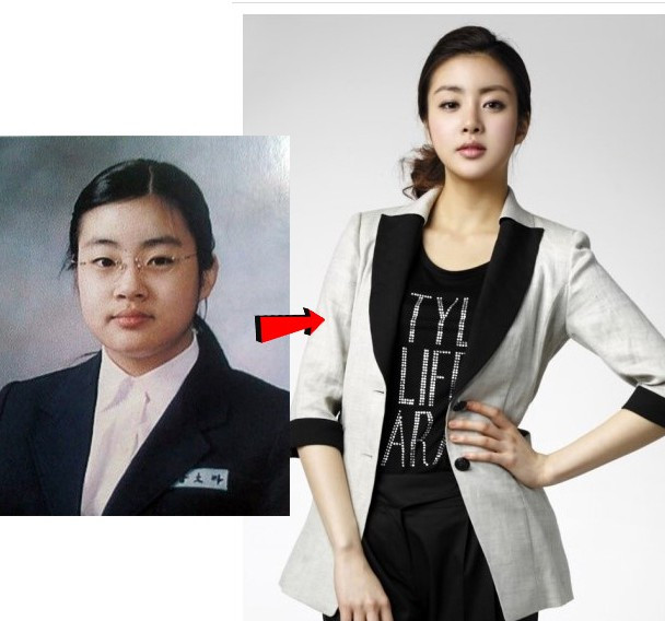 “Vợ ảo” của nhóm trưởng nhóm nhạc đình đám Super Junior - Kang Sora không những mập mà còn già hơn so với những ngôi sao cùng tuổi sinh năm 1990. Đặc biệt có thể thấy được sự tác động của giao kéo khá nhiều trên gương mặt của cô, từ mũi, cằm, mắt… “Vợ ảo” của nhóm trưởng nhóm nhạc đình đám Super Junior - Kang Sora không những mập mà còn già hơn so với những ngôi sao cùng tuổi sinh năm 1990. Đặc biệt có thể thấy được sự tác động của giao kéo khá nhiều trên gương mặt của cô, từ mũi, cằm, mắt…