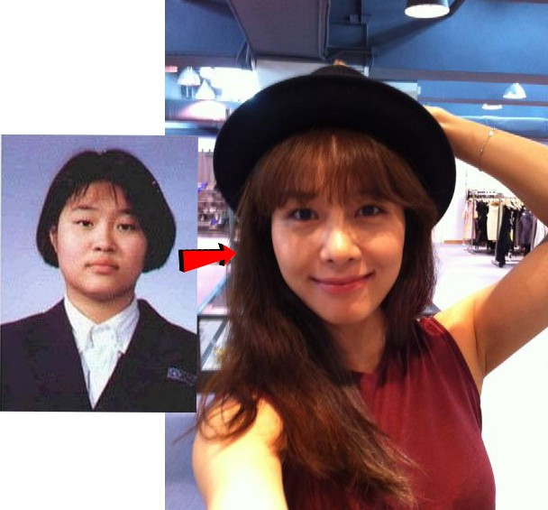 Có thể thấy được cô ca sĩ Ock Joon Hyun cũng đã tác động dao kéo rất nhiều để được xinh đẹp hơn. Sự khác biệt rất dễ để nhìn ra từ má ú, mũi tẹt, mắt nhỏ…đến mắt to, mũi thẳng, mặt thanh mảnh … Có thể thấy được cô ca sĩ Ock Joon Hyun cũng đã tác động dao kéo rất nhiều để được xinh đẹp hơn. Sự khác biệt rất dễ để nhìn ra từ má ú, mũi tẹt, mắt nhỏ…đến mắt to, mũi thẳng, mặt thanh mảnh …