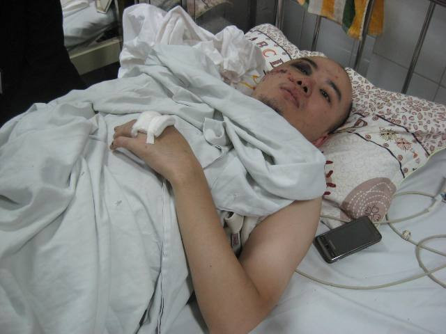 Anh Nguyễn Tài Quyền tại BV Việt Đức Anh Nguyễn Tài Quyền tại BV Việt Đức